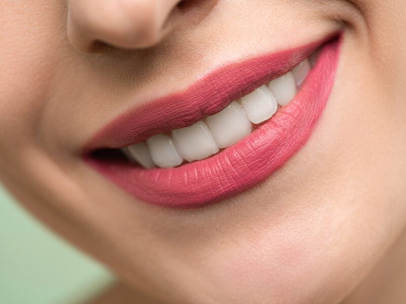 Natural Ways to Strengthen Teeth